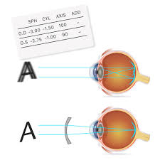 Understanding ‘Spherical’ , ‘Cylinder’ and ‘Axis’ on Your Prescription Card